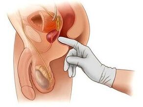 prostatako masajea prostatitisa egiteko